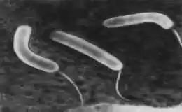 霍乱是什么？可怕吗？专家：可防可控，做好这几点很重要！