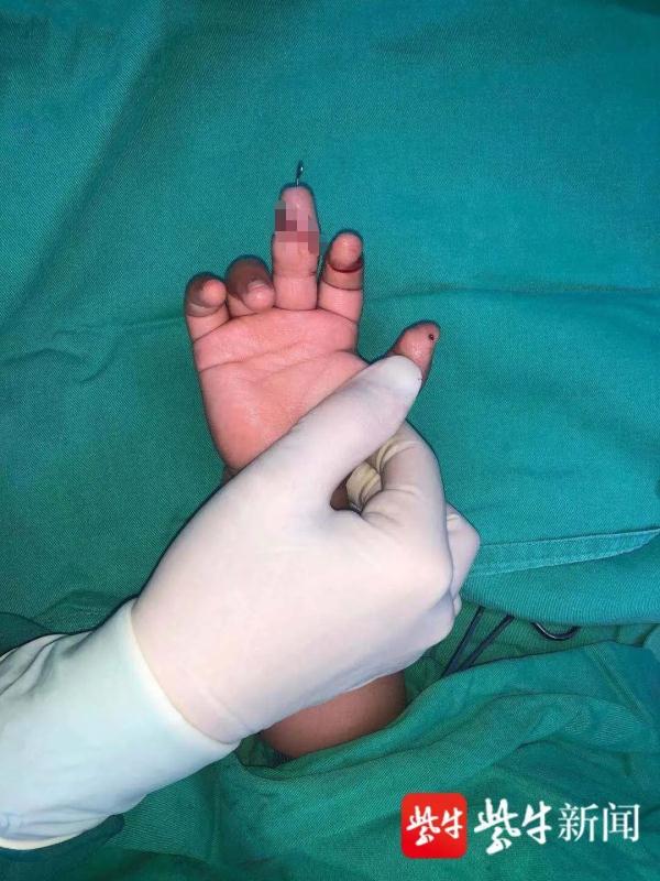 暑假，这种病例增多！